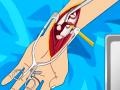 Гульня Arm surgery 2
