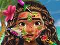 Гульня Moana Skin Doctor