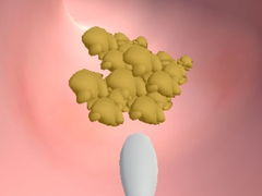 Гульня Earwax Clinic